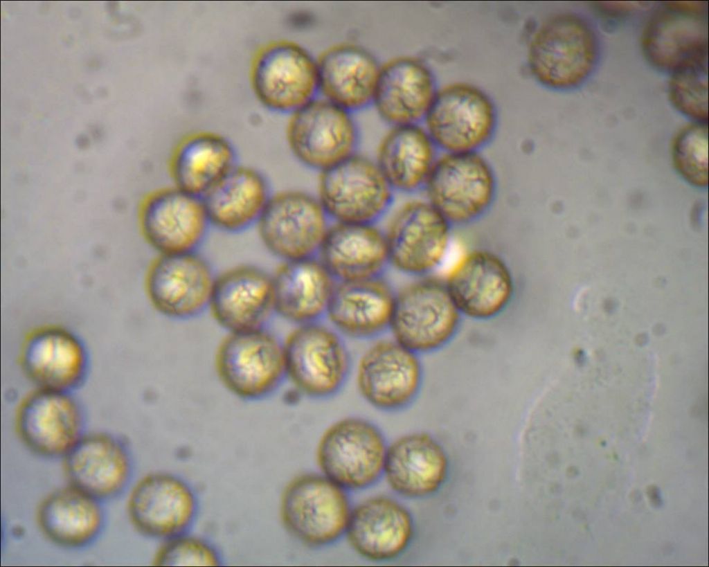 Comatricha o Stemonitopsis?